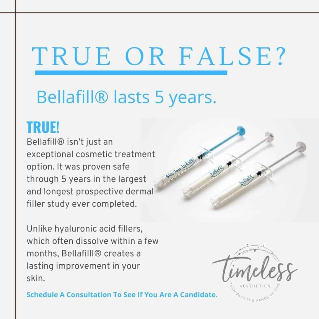 bellafill near me Bellafill® - True or False