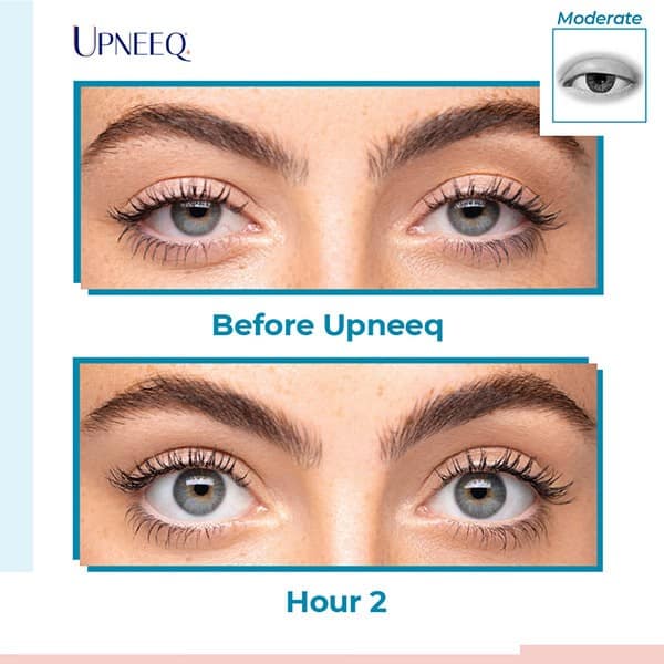 Upneeq® Eye Lift Eyedrops Available at Timeless Aesthetics, LLC Colorado Springs