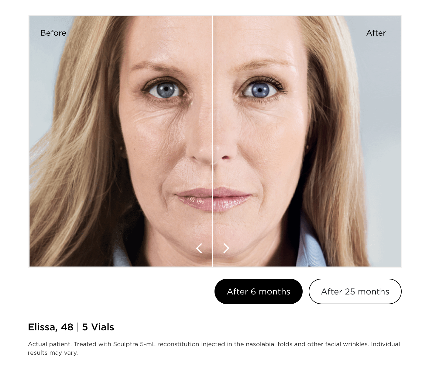 Discover The Science of Biostimulators: How Sculptra and Bellafill Rebuild Collagen Naturally