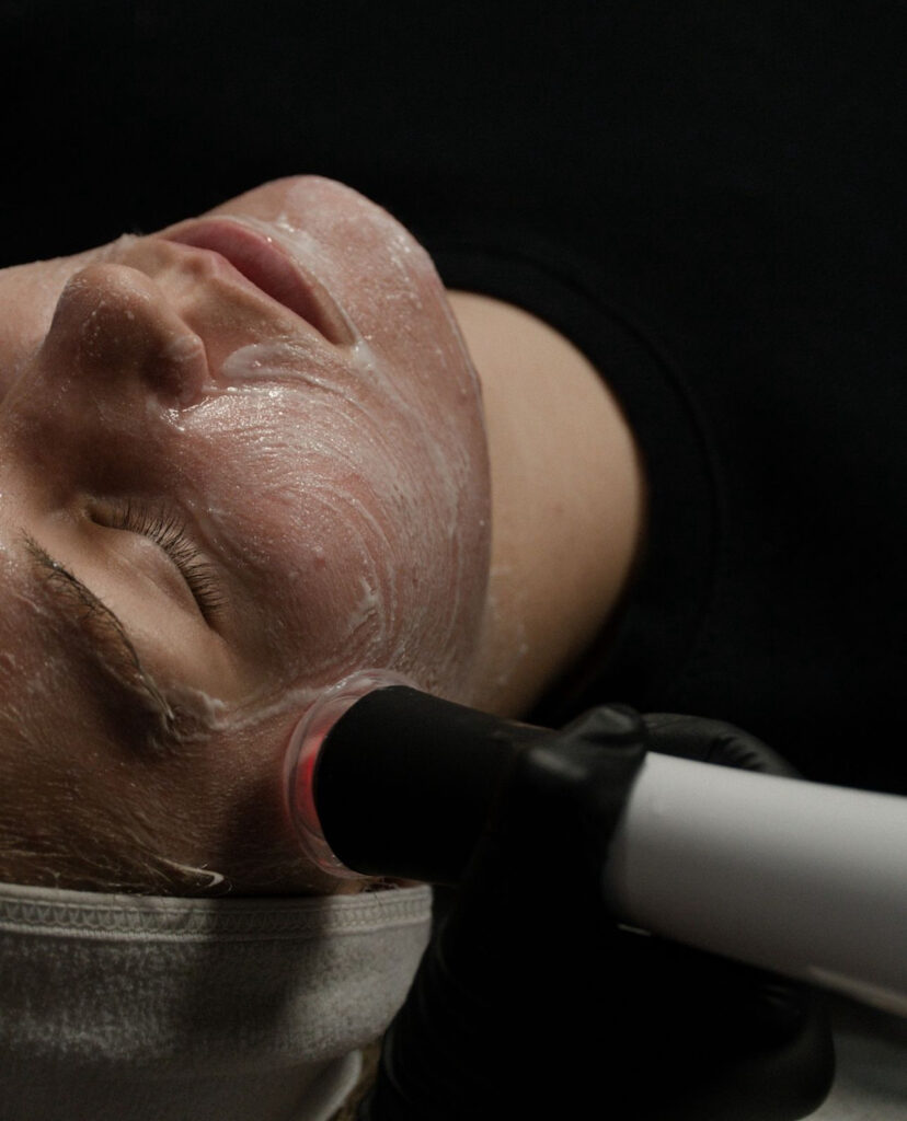 Timeless Aesthetics, LLC | AquaFirme XS Facial Patient receiving an AquaFirme XS facial at Timeless Aesthetics in Colorado Springs.
